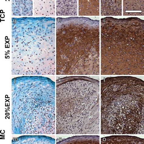 Histology And Immuno Histochemistry On Pellet Cultures From Human