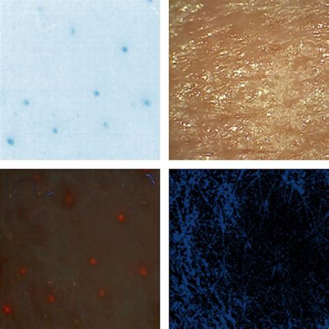 Skin Analysis Machine Color Chart Maikong Skin Observed System Skin