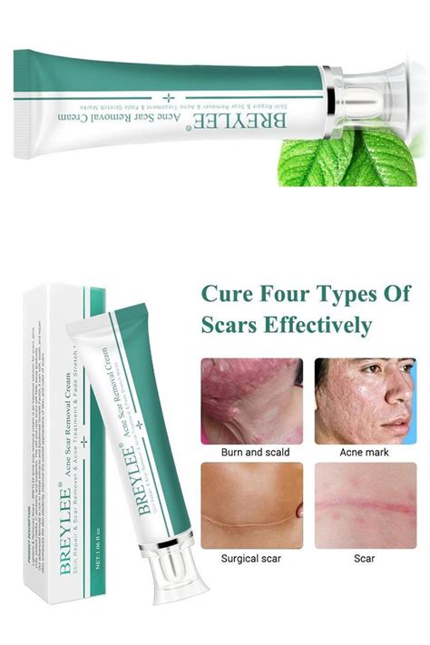 Pin on Acne scar removal cream