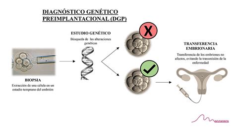 Diagn Stico Gen Tico Preimplantacional Dgp Centro M Dico Manzanera