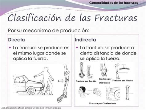 Generalidades De Las Fracturas