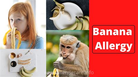 Banana allergy and how to safe from It - Allergie Care