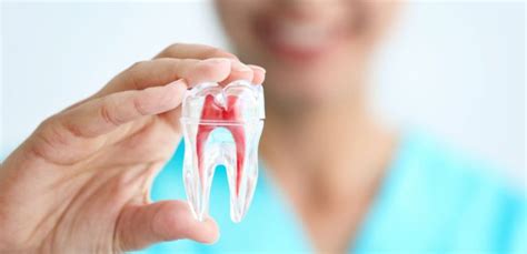 Mastering Root Canal Aftercare: A Guide to Speedy Recovery