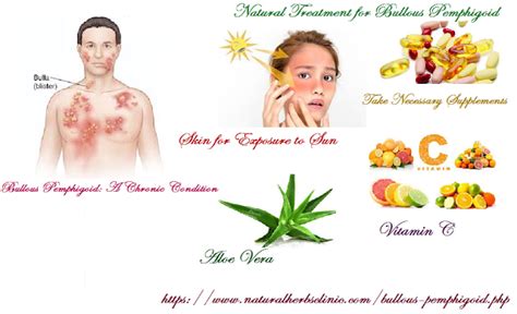 Natural Treatment for Bullous Pemphigoid