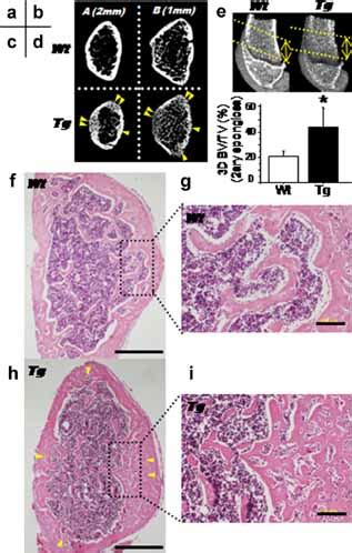 Three Dimensional Anaysis Of Bone In Col1a1 CaPPR Transgenic Mice