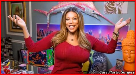 Wendy Williams Plastic Surgery - Celebrities Plastic Surgery