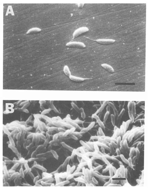 Scanning Electron Micrographs Of C Crescentus Cells Attached To A