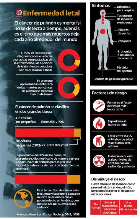 Desarrollan diagnóstico no invasivo del cáncer de pulmón video