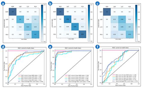 Biomedicines Free Full Text An Artificial Intelligence Enabled Ecg