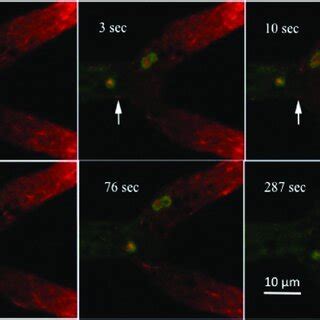 Pdf The Structure Of Prevacuolar Compartments In Neurospora Crassa As