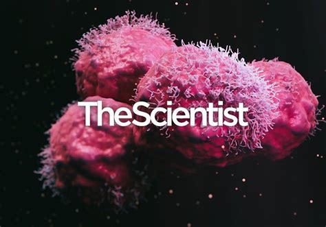 A Spotlight on Cancer Cell Metabolism | The Scientist Magazine®