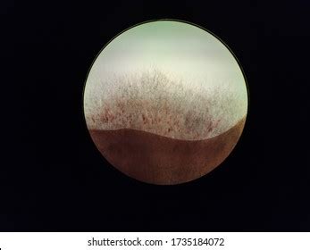 Fusarium Oxysporum Colony Under Microscope Stock Photo 1735184072 ...