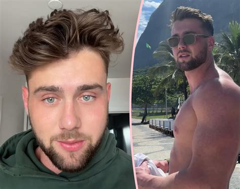 Too Hot To Handle Alum Harry Jowsey Reveals ‘scary Skin Cancer