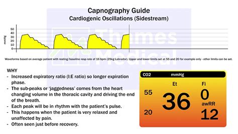 Capnography Waveform Examples