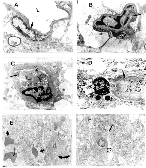 Transmission electron micrographs of representative specimens derived ...