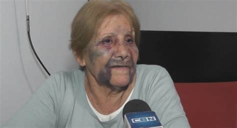 Brutal ataque a una mujer de 79 años La Info Semanal