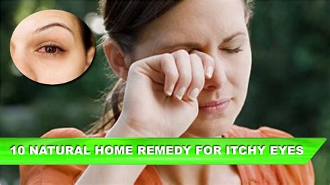 Top 10 Home Remedies For Itchy Eyes Instant Relief For Watery Eyes Youtube