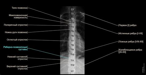 Позвоночник рентгенограммы : нормальная анатомия | e-Anatomy
