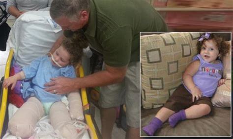 Ireland Nugent Girl 2 Who Lost Both Legs After Father Ran Her Over In Lawnmower Is Pictured