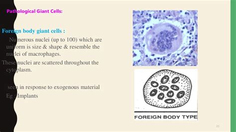 GIANT CELLS