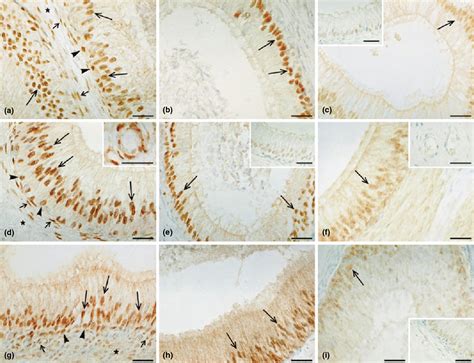 Immunolocalization Of Androgen Receptor In The Boar Epididymis The