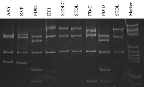 Polyacrylamide Gel Showing Rflp Patterns Of Phytoplasma Rdna