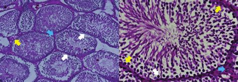 Microscopic description of the cross-section of the seminiferous ... 