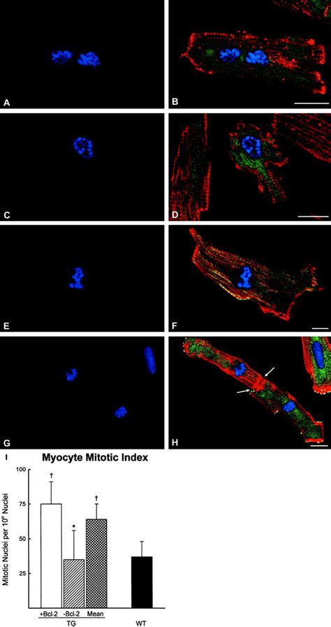 Bcl 2 Overexpression Promotes Myocyte Proliferation Pnas