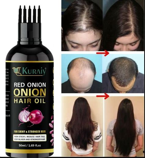 Kuraiy Onion Hair Oil Day Challenge For Hair Growth Ml