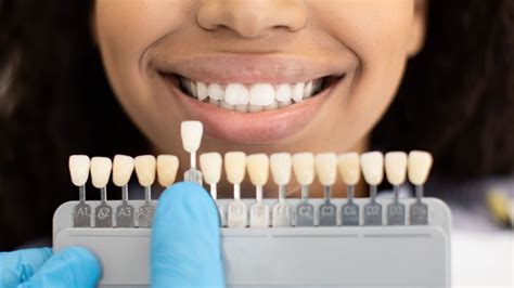 Saiba Como Feito O Clareamento De Dentes Tipos E Quanto Custa