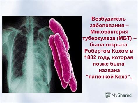 Презентация на тему: "ТУБЕРКУЛЁЗ ". Скачать бесплатно и без регистрации.