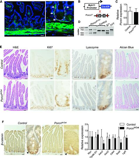 Porcn Loss In Intestinal Smooth Muscle Cells And Semfs Does Not