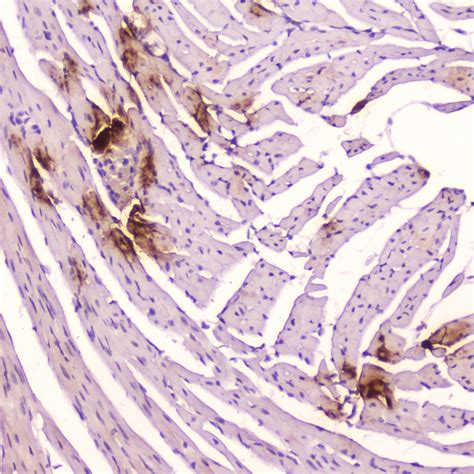 Anti Natriuretic Hormone 9