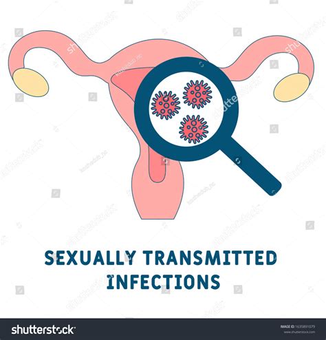 Sexually Transmitted Diseases Clipart Free