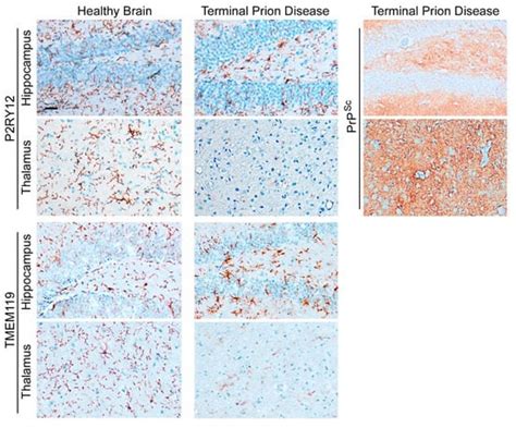 Cells Free Full Text Loss Of Homeostatic Microglia Signature In