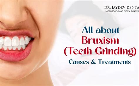 Treatment For Bruxism Teeth Grinding Dr Jaydev Dental