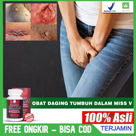 Jual Obat Daging Tumbuh Di Dalam Miss V Atau Vagina Benjolan Miss V