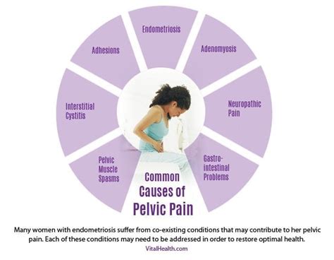 causes-of-pelvic-pain | Vital Health Endometriosis Center