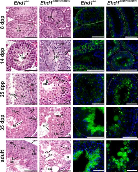 Frontiers A Missense Mutation In Ehd1 Associated With Defective