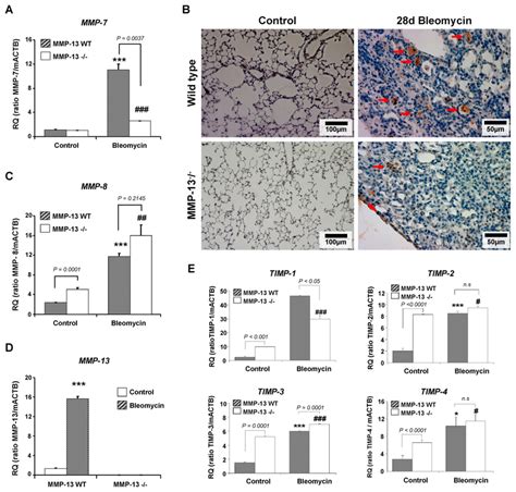 Expression Of Mmps And Timps In Lungs Of Bleomycin Challenged