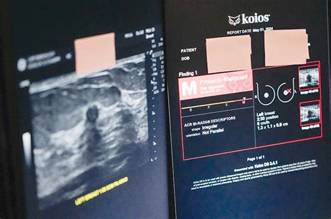 The role of AI in X-ray diagnosis: enhancing or replacing doctors? – ARAB TIMES – KUWAIT NEWS