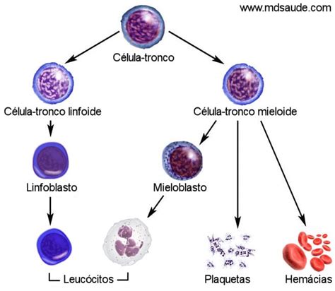 SÍndrome MielodisplÁsica Mielodisplasia Smd Mdsaúde