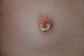 Ice Cream Pussy Tits Porn Pictures XXX Photos Sex Images