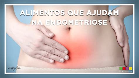 Os Melhores E Piores Alimentos Para Endometriose Preste Aten O Youtube