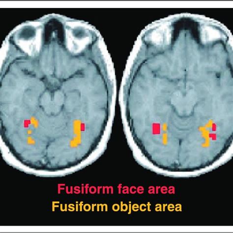 Pdf Dissecting Contributions Of Prefrontal Cortex And Fusiform Face