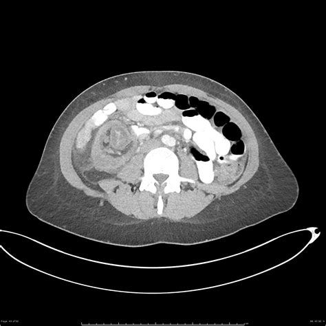 Image Radiopaedia Org