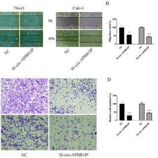 The Knockdown Of Circ APBB1IP Inhibited Proliferation And Promoted