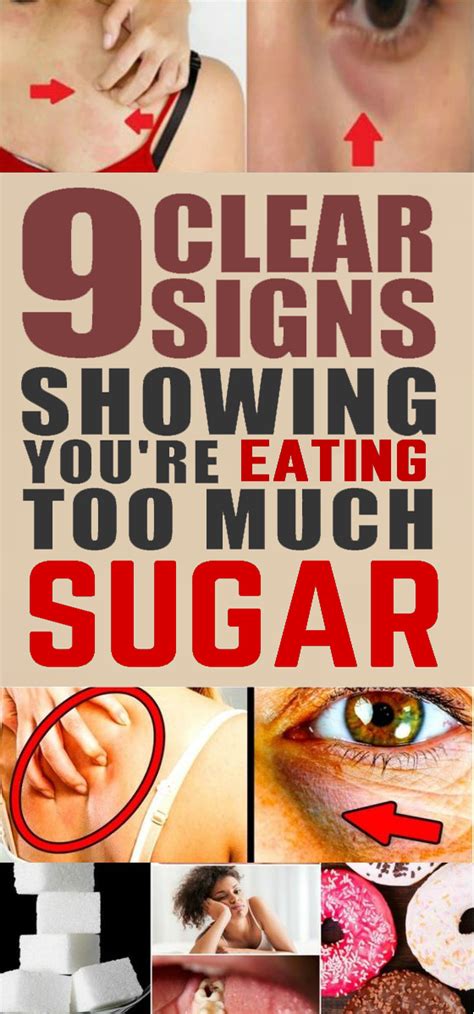 9 Clear Signs Showing Youre Eating Too Much Sugar Stop Eating