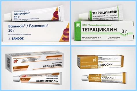Мазь от фурункулов — с антибиотиком и вытягивающие — Все о лечении зубов