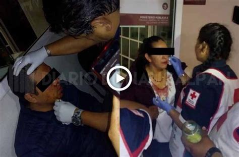 Graban Otro Abuso De Autoridad De Policías De Naucalpan